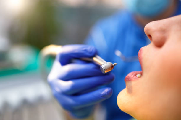 Best Teeth Whitening  in Matheny, CA
